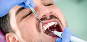 3nov2016---dentista-tartaro-dor-de-dente-limpeza-1478215369539_615x300