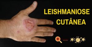 LEISHMANIOSE-CUTÂNEA-CAPA-1000x509