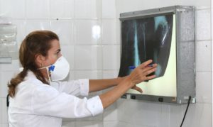 tuberculose