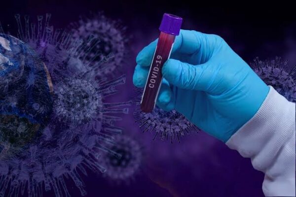 Arapongas-registra-74-novos-casos-de-coronavirus-e-00520628-0-202102281653