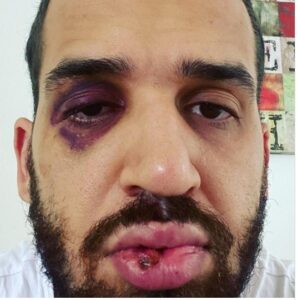 Medico-do-Parana-e-agredido-apos-defender-lockdown-00520757-0-202103012122