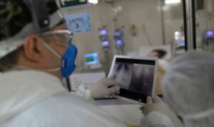 _radiografia_de_torax_coronaviruscovid-19_hospital_sao_paulo1205200326