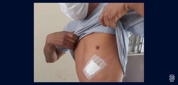 Polícia Civil prende homem que esfaqueou o irmão em Apucarana