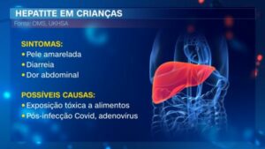 Hepatite infantil de causa desconhecida já tem registro em 12 países