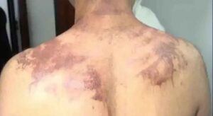 Quatro pessoas são presas por trote que deixou cerca de 20 universitários com queimaduras na UFPR