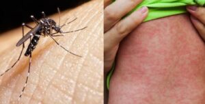 Casos de dengue aumentam em Jandaia do Sul e Prefeitura faz alerta