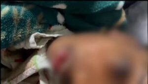 Menino de 5 anos é alvo de xingamentos em escola por ser negro