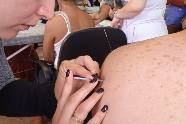 Paraná forma primeira turma de médicos para atuar com acupuntura no SUS