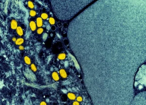 Europa eleva risco de mpox após registro de nova cepa na Suécia: ‘devemos estar preparados para mais casos’