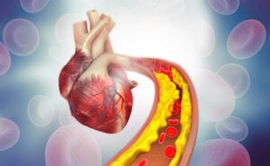 Prevenção do Colesterol: Um Caminho Essencial para a Saúde do Coração